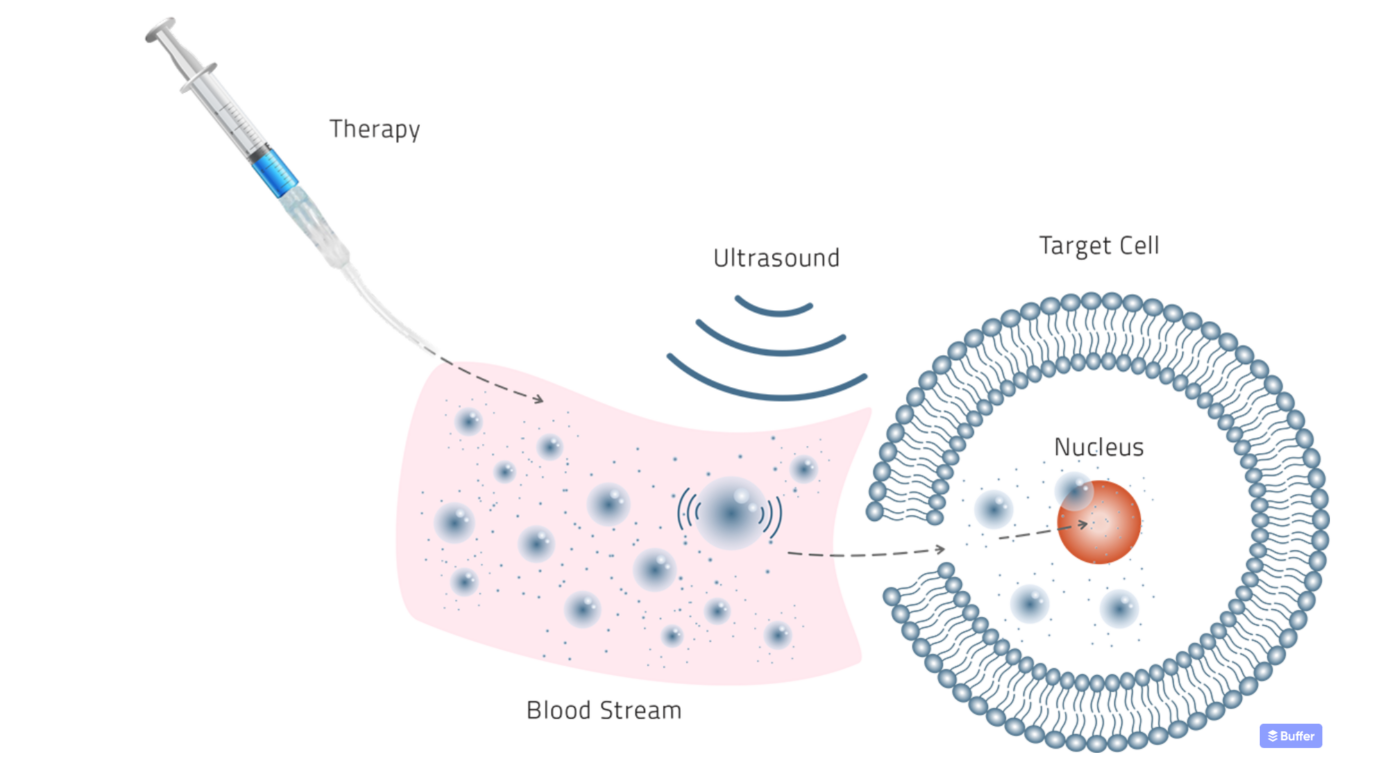 Gene therapy delivery through ultrasound sonoporation 